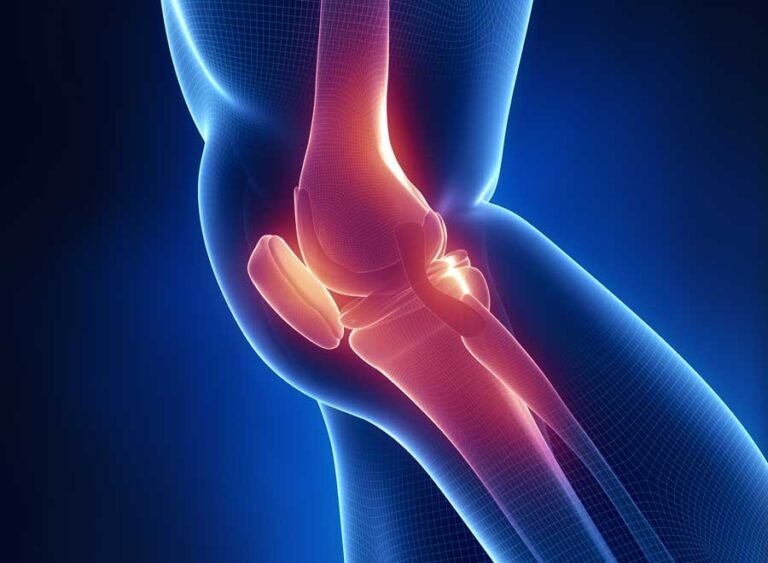 Renowned Knee Replacement Expert in Andhra Pradesh